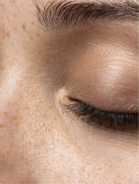 Close-up of bare, makeup-free skin